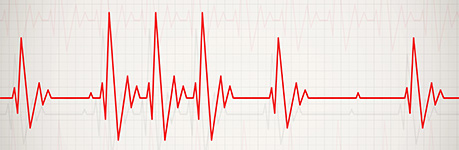 Arritmias y conducción
