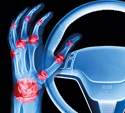 Artrosis y conducción