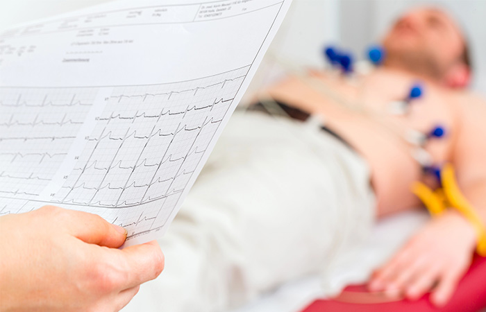 salud vial arritmias